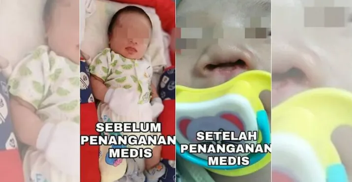 Seorang Bayi di Konawe Diduga Jadi Korban Malpraktik