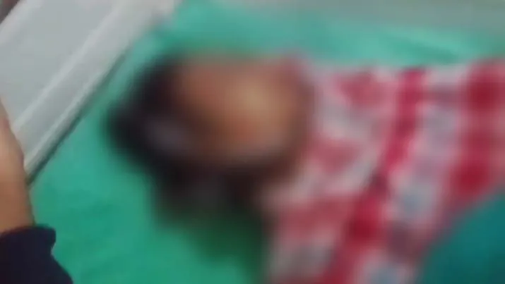 Sempat Kritis, Korban Lakalantas Mobil vs Motor di Konawe Meninggal