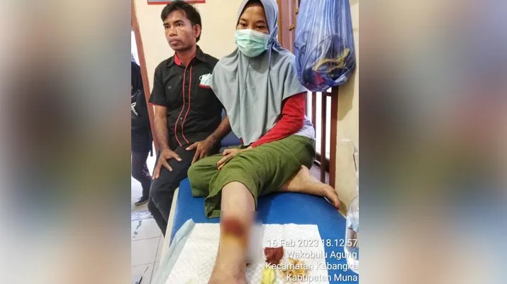 Petugas Pantarlih Asal Muna Digigit Anjing saat Mendata Warga