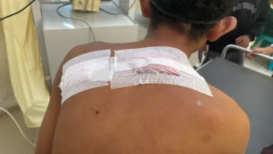 Seorang Pria di Kendari Dianiaya Temannya Pakai Sajam