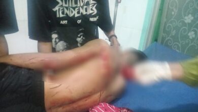 Cemburu Mantan Pacarnya Bersama Pria Lain, Pemuda di Kolaka Ditikam Pisau Dapur