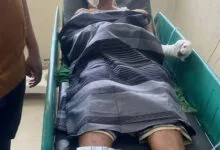 Kecelakaan Kerja PT SMS di Moramo Konsel, 5 Orang Alami Luka Bakar Serius