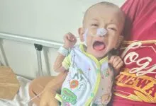 Dirawat di RSUD Kota Kendari, Bayi Delapan Bulan Alami Gizi Buruk Butuh Uluran Tangan