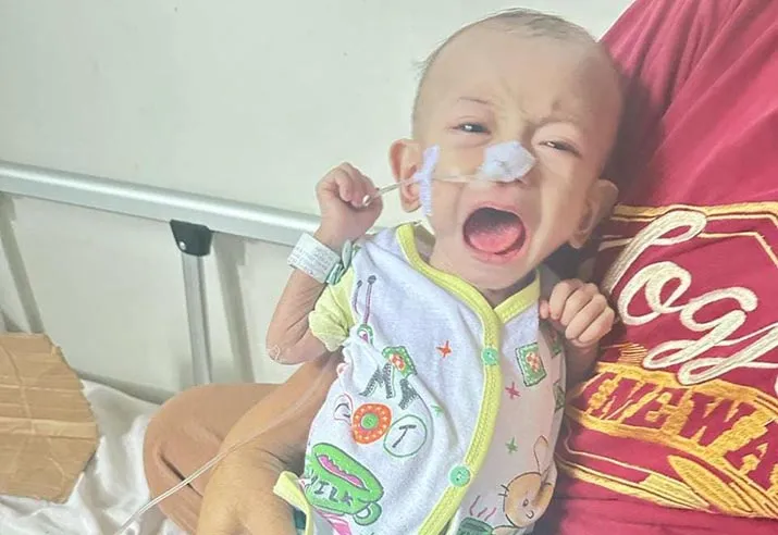 Dirawat di RSUD Kota Kendari, Bayi Delapan Bulan Alami Gizi Buruk Butuh Uluran Tangan