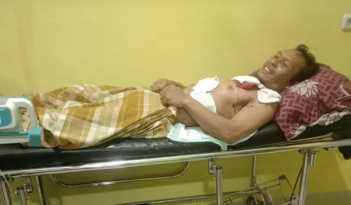 Lagi-Lagi, Warga Muna Barat Diterkam Buaya